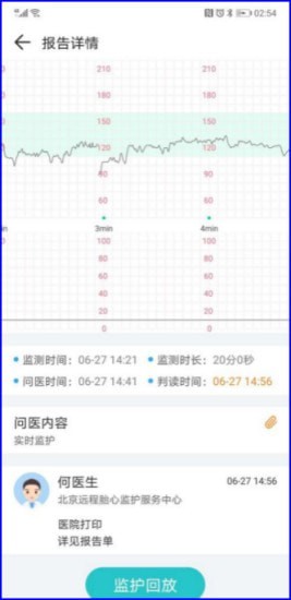 胎心监护