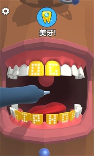 抖音洗牙