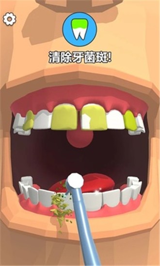抖音洗牙